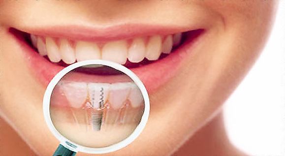 стоматология в цюрихе